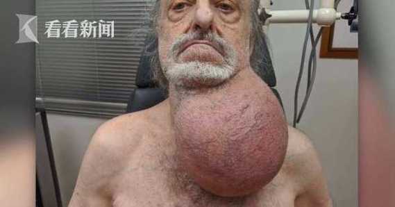 新澳门彩最快开奖记录和患瘤拒上夜班被开除与患瘤拒上夜班被开除有赔偿吗